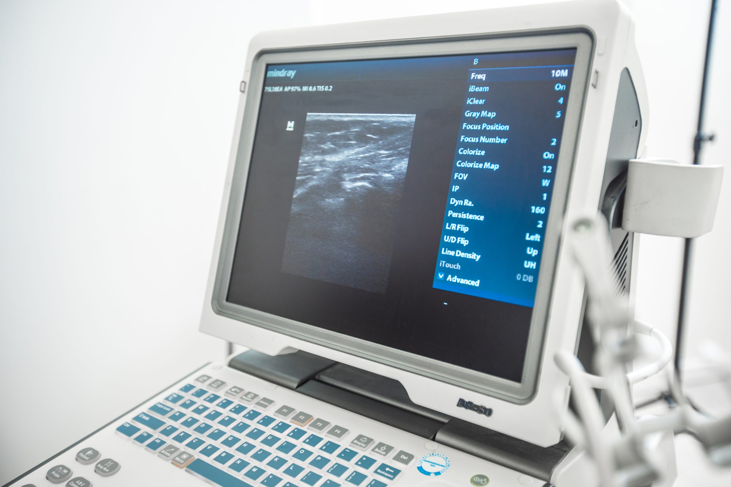 Echografie