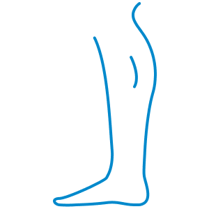 Enkelklachten
